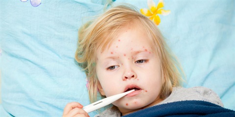 Photo of a child sick with measles.